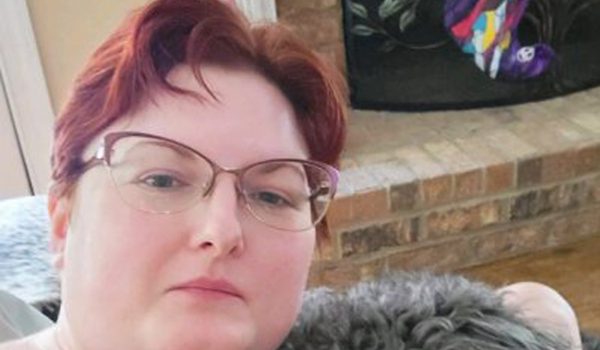 A Journey Of Chin Liposuction