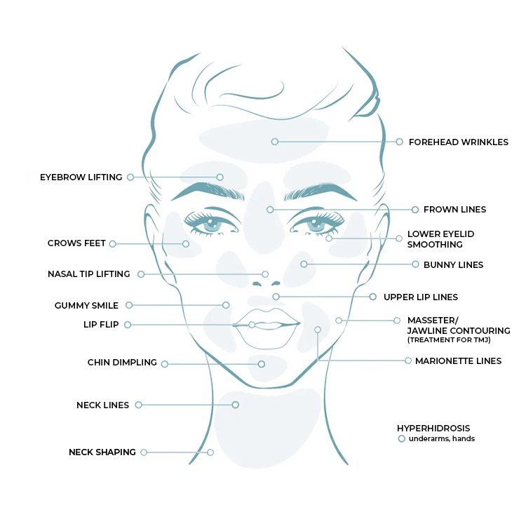 Charlotte Skin & Laser botox infographic