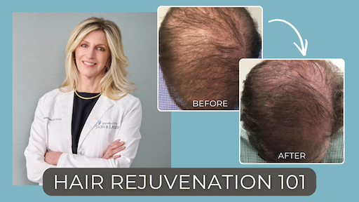 Hair Loss Awareness Month: What Dermatologists Know About Shedding and Solutions